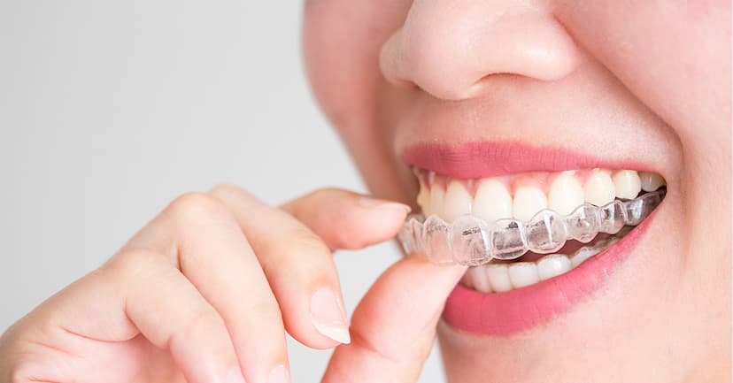 Discover Affordable Invisible dental braces