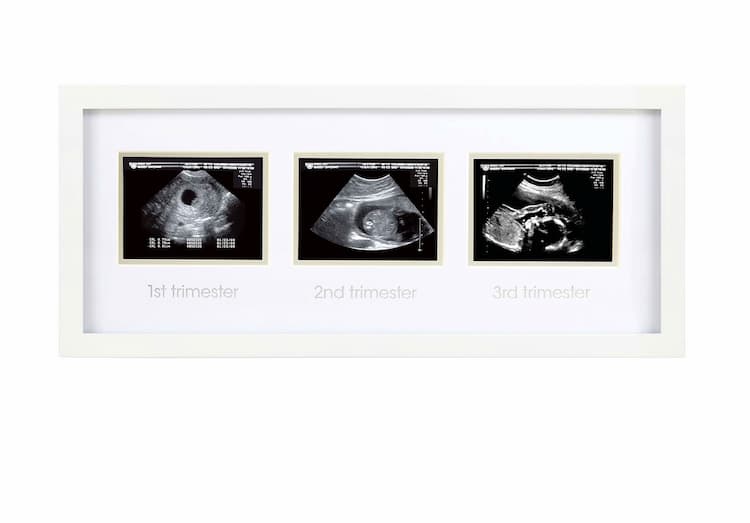 Nursery Picture Frames